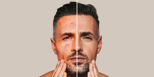 guide for men to fix red face
