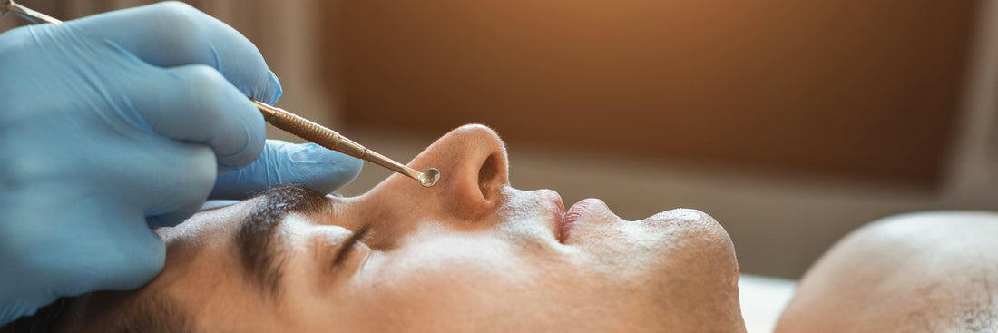 Black Heads On Your Nose - Causes And Solutions For Men