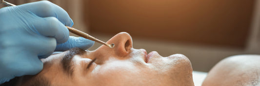 Black Heads On Your Nose - Causes And Solutions For Men