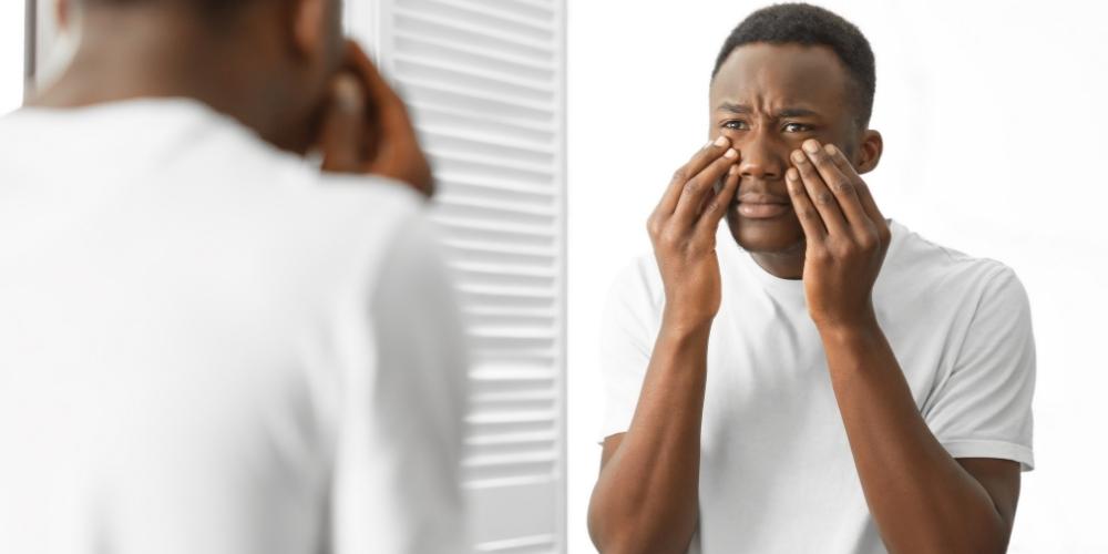 best skincare tips for black men